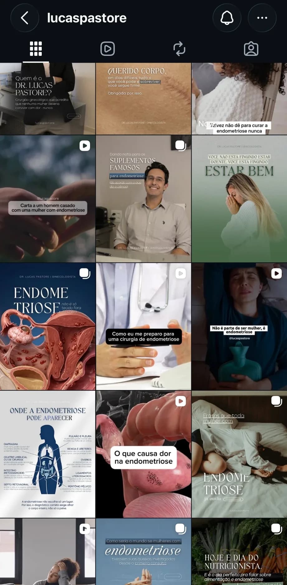 Grade do perfil @lucaspastore no Instagram, com publicações sobre endometriose, suplementos e cirurgia